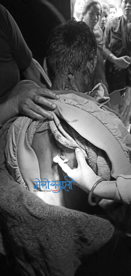 बर्दियाको गेरुवामा बाघको आक्रमण, एकजना गम्भीर घाइते