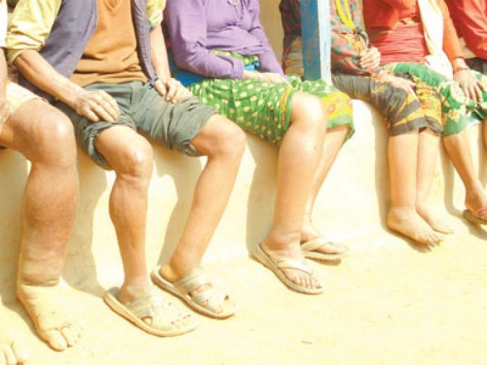 हात्तीपाइलेको आमऔषधी सेवन कार्यक्रमको प्रभावकारिता बुझ्न नेपालगन्जमा सर्भे गरिँदै