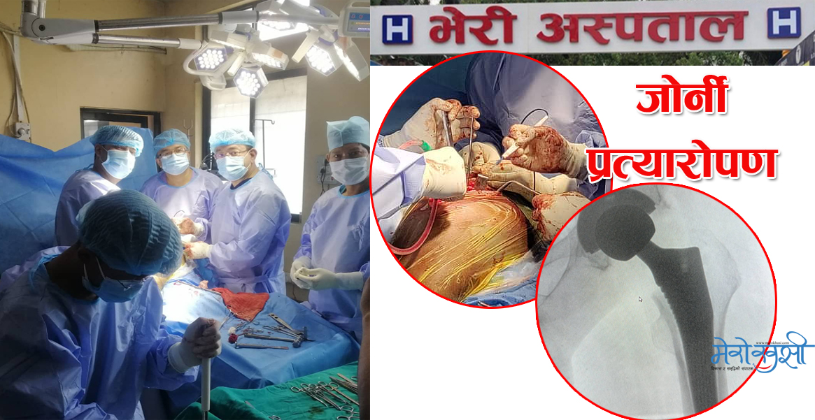 पश्चिम नेपालमै पहिलो पटक भेरी अस्पतालमा नियमित पूर्ण जोर्नी प्रत्यारोपण